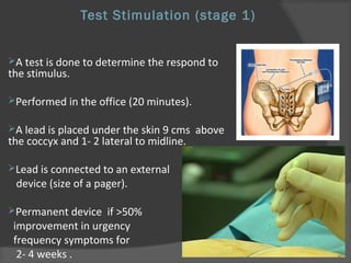 Test Stimulation (stage 1)
A test is done to determine the respond to
the stimulus.
Performed in the office (20 minutes).
A lead is placed under the skin 9 cms above
the coccyx and 1- 2 lateral to midline.
Lead is connected to an external
device (size of a pager).
Permanent device if >50%
improvement in urgency
frequency symptoms for
2- 4 weeks .
 
