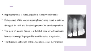 radiographic manifestations of endocrine disorders.pptx