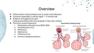 Acute Respiratory Infections in Children .pptx