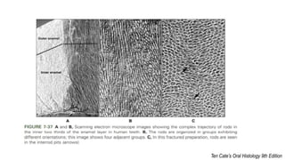 Interlocking Enamel Rods Enamel Rods and its implications | PPT