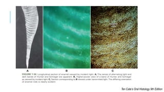 Interlocking Enamel Rods Enamel Rods and its implications | PPT