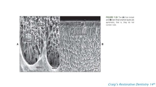 Enamel Rods and its implications | PPT