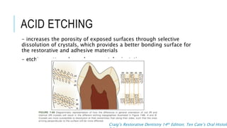 Enamelon Rods Enamel Rods and its implications | PPT