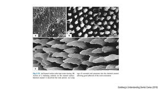 Enamel Rods and its implications | PPT