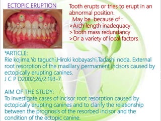 ERUPTION AND SHEDDING | PPTX