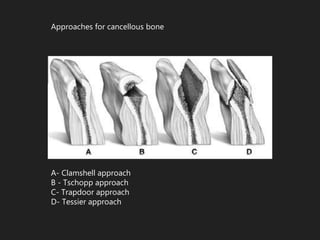 non vascular grafts in oral and maxillofacial surgry | PPTX
