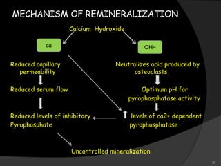 MECHANISM OF REMINERALIZATION
Calcium Hydroxide
Reduced capillary Neutralizes acid produced by
permeability osteoclasts
Reduced serum flow Optimum pH for
pyrophosphatase activity
Reduced levels of inhibitory levels of ca2+ dependent
Pyrophosphate pyrophosphatase
Uncontrolled mineralization
ca OH−
25
 