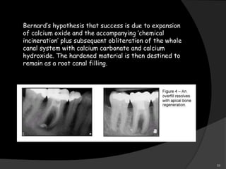 Bernard’s hypothesis that success is due to expansion
of calcium oxide and the accompanying ‘chemical
incineration’ plus subsequent obliteration of the whole
canal system with calcium carbonate and calcium
hydroxide. The hardened material is then destined to
remain as a root canal filling.
59
 