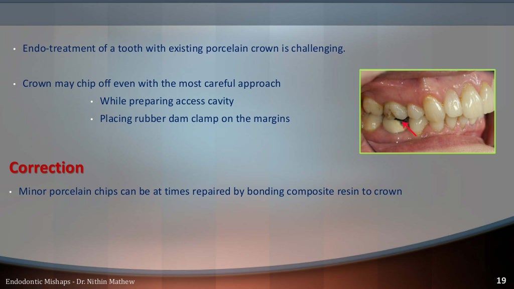 Endodontic Mishaps