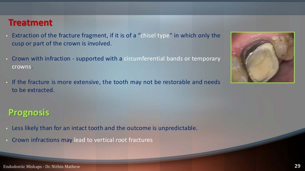 Endodontic Mishaps