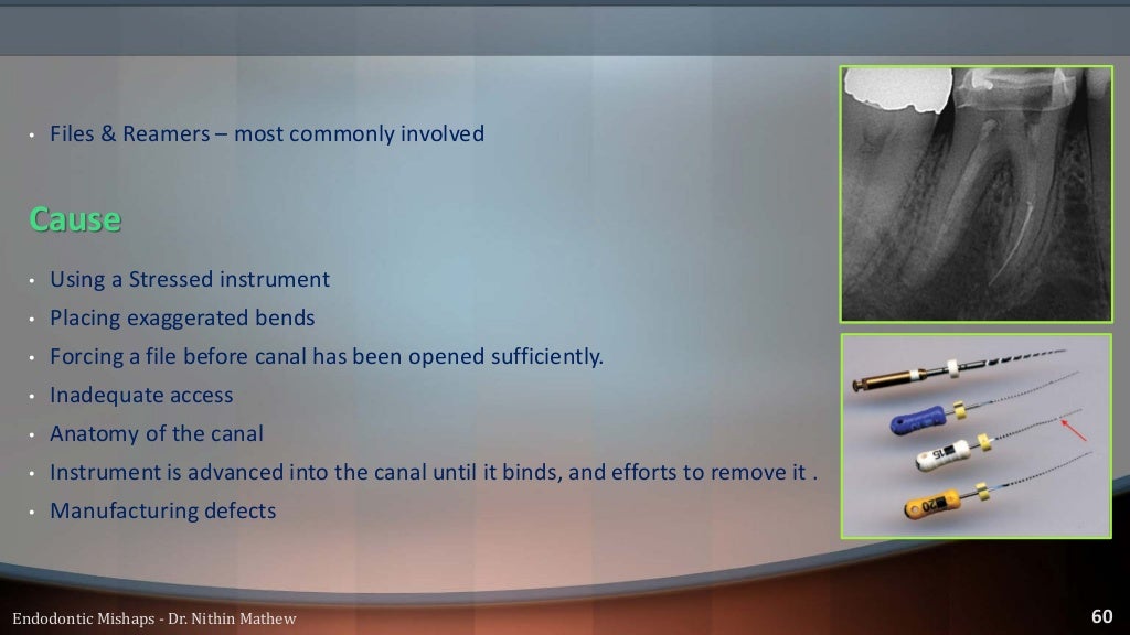 Endodontic Mishaps