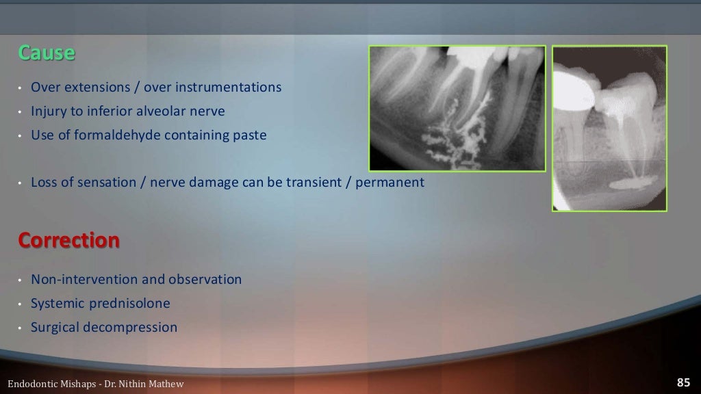 Endodontic Mishaps