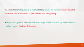 3.Lesions that are hyperemic & painful to the pressure of closure-pressure directed
toward an area of exostosis - Spur of bone or a foreign body.
4.Hyperemic , painful and detached areas of epithelium that develop on the slope of
residual ridges - Occlusal disharmony
10
 