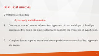 Basal seat mucosa
2 problems associated are
- hypertrophy and inflammation.
1. Continuous wear of dentures - Generalized hyperemia of crest and slopes of the ridges
accompanied by pain in the muscles attached to mandible, the production of hyperkeratin.
2. Complete denture opposite natural dentition or partial denture causes localized hyperemia
and edema.
12
 
