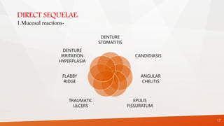 DIRECT SEQUELAE:
1.Mucosal reactions-
DENTURE
STOMATITIS
CANDIDIASIS
ANGULAR
CHELITIS
EPULIS
FISSURATUM
TRAUMATIC
ULCERS
FLABBY
RIDGE
DENTURE
IRRITATION
HYPERPLASIA
17
 