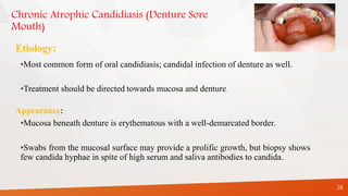 Chronic Atrophic Candidiasis (Denture Sore
Mouth)
Etiology:
•Most common form of oral candidiasis; candidal infection of denture as well.
•Treatment should be directed towards mucosa and denture.
Appearance:
•Mucosa beneath denture is erythematous with a well-demarcated border.
•Swabs from the mucosal surface may provide a prolific growth, but biopsy shows
few candida hyphae in spite of high serum and saliva antibodies to candida.
28
 