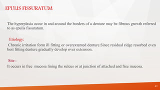 EPULIS FISSURATUM
The hyperplasia occur in and around the borders of a denture may be fibrous growth referred
to as epulis fissuratum.
Etiology:
Chronic irritation form ill fitting or overextented denture.Since residual ridge resorbed even
best fitting denture gradually develop over extension.
Site :
It occurs in free mucosa lining the sulcus or at junction of attached and free mucosa.
41
 