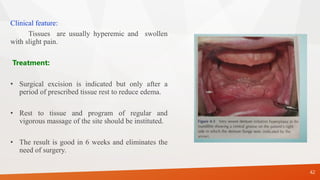 Clinical feature:
Tissues are usually hyperemic and swollen
with slight pain.
Treatment:
• Surgical excision is indicated but only after a
period of prescribed tissue rest to reduce edema.
• Rest to tissue and program of regular and
vigorous massage of the site should be instituted.
• The result is good in 6 weeks and eliminates the
need of surgery.
42
 