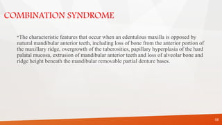 COMBINATION SYNDROME
“The characteristic features that occur when an edentulous maxilla is opposed by
natural mandibular anterior teeth, including loss of bone from the anterior portion of
the maxillary ridge, overgrowth of the tuberosities, papillary hyperplasia of the hard
palatal mucosa, extrusion of mandibular anterior teeth and loss of alveolar bone and
ridge height beneath the mandibular removable partial denture bases.
68
 