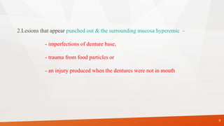 2.Lesions that appear punched out & the surrounding mucosa hyperemic -
- imperfections of denture base,
- trauma from food particles or
- an injury produced when the dentures were not in mouth
9
 
