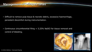 Management of C-shaped canals
• Difficult to remove pulp tissue & necrotic debris, excessive haemorrhage,
persistent discomfort during instrumentation.
• Continuous circumferential filing + 5.25% NaOCl for tissue removal and
control of bleeding.
 