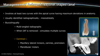 Management of S-shaped / Bayonet shaped canal
• Involves at least two curves with the apical curve having maximum deviations in anatomy.
• Usually identified radiographically : mesiodistally
• Buccolingually
• Multi-angled radiographs
• When IAF is removed : simulates multiple curves
• Common :
• Maxillary lateral incisors, canines, premolars
• Mandibular molars
 