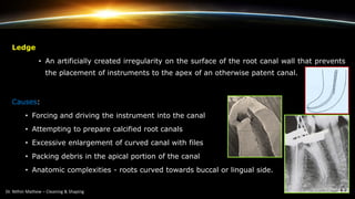 Ledge
• An artificially created irregularity on the surface of the root canal wall that prevents
the placement of instruments to the apex of an otherwise patent canal.
Causes:
• Forcing and driving the instrument into the canal
• Attempting to prepare calcified root canals
• Excessive enlargement of curved canal with files
• Packing debris in the apical portion of the canal
• Anatomic complexities - roots curved towards buccal or lingual side.
 