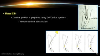 • Phase II B :
• Coronal portion is prepared using GG/Orifice openers
: remove coronal constriction
 
