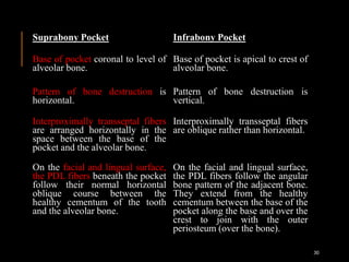 Suprabony Pocket Infrabony Pocket
Base of pocket coronal to level of
alveolar bone.
Base of pocket is apical to crest of
alveolar bone.
Pattern of bone destruction is
horizontal.
Pattern of bone destruction is
vertical.
Interproximally transseptal fibers
are arranged horizontally in the
space between the base of the
pocket and the alveolar bone.
Interproximally transseptal fibers
are oblique rather than horizontal.
On the facial and lingual surface,
the PDL fibers beneath the pocket
follow their normal horizontal
oblique course between the
healthy cementum of the tooth
and the alveolar bone.
On the facial and lingual surface,
the PDL fibers follow the angular
bone pattern of the adjacent bone.
They extend from the healthy
cementum between the base of the
pocket along the base and over the
crest to join with the outer
periosteum (over the bone).
30
 