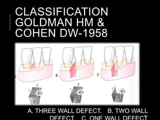 CLASSIFICATION
GOLDMAN HM &
COHEN DW-1958
A. THREE WALL DEFECT. B. TWO WALL
32
 