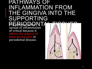 PATHWAYS OF
INFLAMMATION FROM
THE GINGIVA INTO THE
SUPPORTING
PERIODONTAL TISSUES
5
The pathway of the
spread of inflammation
of critical because it
affects the pattern of
bone destruction in
periodontal disease.
 