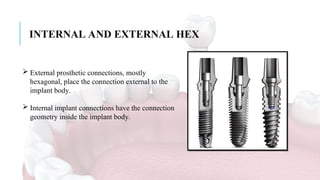 External Hex Connection BASICS OF IMPLANTOLOGY- IMPLANT SURFACE TOPOGRAPHY COMPONENTS PARTS AND ...