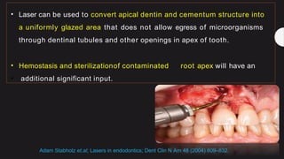 seminar 12 Lasers in endodontics.pptxZZZZZZZZZZZZZZZZZZZZZZZZZZZ | PPTX
