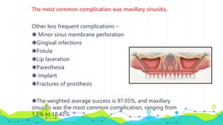 The most common complication was maxillary sinusitis,
Other less frequent complications –
◉ Minor sinus membrane perforation
◉Gingival infections
◉Fistula
◉Lip laceration
◉Paresthesia
◉ Implant
◉Fractures of prosthesis
◉The weighted average success is 97.05%, and maxillary
sinusitis was the most common complication, ranging from
1.5% to 18.42%
 