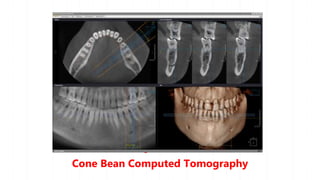 The big concept!
Cone Bean Computed Tomography
 