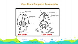 Cone Beam Computed Tomography
Fan beam Cone beam
 