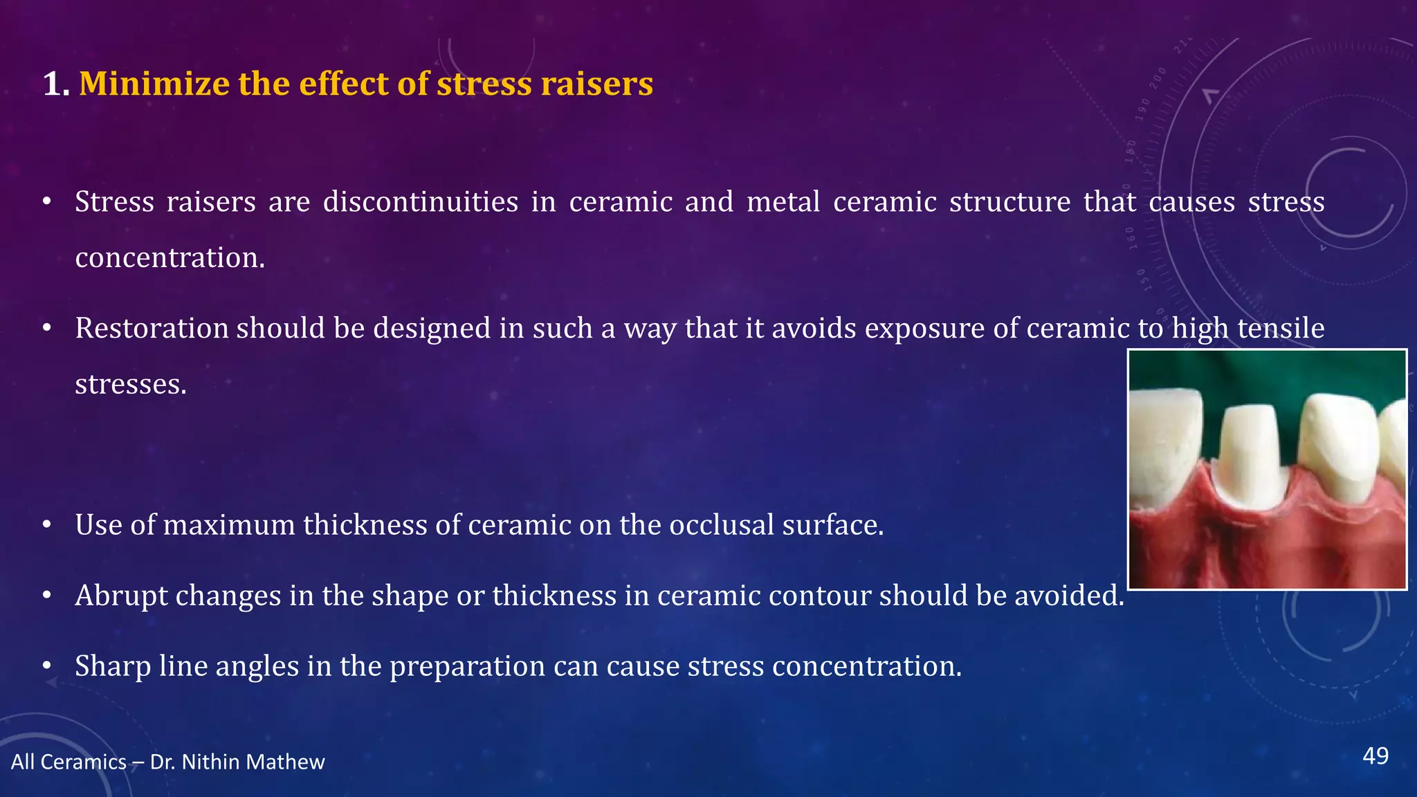 All Ceramics Dental PPT