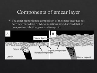 Smear Layer Modifications smear layer in the root canal system.pptx