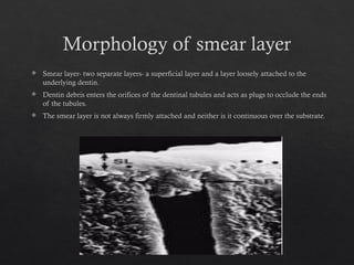 smear layer in the root canal system.pptx