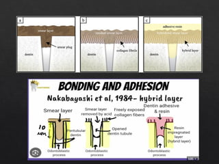 Smear Layer Modifications smear layer in the root canal system.pptx