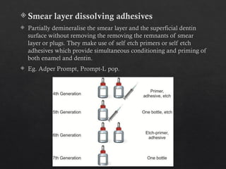 Smear Layer Modifications smear layer in the root canal system.pptx