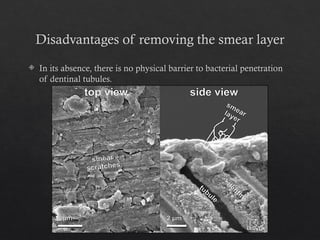 Smear Layer Modifications smear layer in the root canal system.pptx