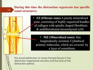 15
During this time the distraction regenerate has specific
zonal structures:
• FZ (Fibrous zone)-A poorly mineralized
zone, consisting of highly organized bundles
of collagen with spindle shaped fibroblasts
& undifferentiated mesenchymal cells.
• MZ (Mineralized zone)- Has
longitudinally oriented, Cylindrical
primary trabeculae, which are covered by
a layer of osteoblasts.
This zonal distribution of newly formed tissues in the
distraction regenerate remains until the end of the
distraction period.
 