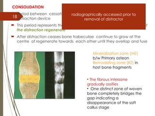18
CONSOLIDATION
 Period between cessation of traction forces and removal of the
distraction device
 This period represents the time required for complete mineralization of
the distraction regenerate
 After distraction ceases bone trabeculae continue to grow at the
centre of regenerate towards each other until they overlap and fuse
Mineralization zone (MZ)
b/w Primary osteon
Remodeling zone (RZ) in
host bone fragments
• The fibrous interzone
gradually ossifies
• One distinct zone of woven
bone completely bridges the
gap indicating a
disappearance of the soft
callus stage
radiographically accessed prior to
removal of distractor
 