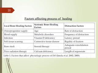 20
Factors affecting process of healing
 