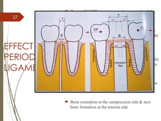 27
EFFECT ON
PERIODONTAL
LIGAMENT
 During DO PDL is compressed on one side of the
tooth & stretched on the opposite side ˘
 The location of compression /tension sites and the
related sequence of adaptive changes depend on the
type of distraction device ( tooth borne or bone
borne ) & the location of the distraction forces
 Tooth borne distraction devices are attached directly
to the teeth there by transmitting distraction forces
from the teeth to the bone via the PDL
 During consolidation period PDL adapts to its new
position
 Bone resorption at the compression side & new
bone formation at the tension side
 