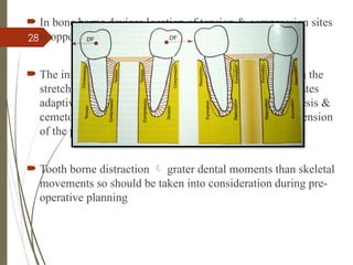 28
 In bone borne devices location of tension & compression sites
is opposite to the that during tooth borne distraction
 The initial tension / pressure stress’s that accumulated in the
stretched/ compressed periodontal ligament fibers activates
adaptive mechanism such as bone resorption , osteogenesis &
cemetogenesis restoring the equilibrium in length and tension
of the periodontal ligament
 Tooth borne distraction  grater dental moments than skeletal
movements so should be taken into consideration during pre-
operative planning
 