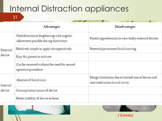 31
Internal Distraction appliances
Zurich Maxillary Distractor
( Lorenz)
 