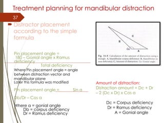 37
Treatment planning for mandibular distraction
 Distractor placement
according to the simple
formula
Pin placement angle =
180 – Gonial angle x Ramus
deficiency
Total deficiency
Where Pin placement angle = angle
between distraction vector and
mandibular plane
Later this formula was modified
Pin placement angle = Sin a
Db/Dr – Cos a
Where a = gonial angle
Db = corpus deficiency
Dr = Ramus deficiency
Amount of distraction:
Distraction amount = Dc + Dr
– 2 (Dc x Dr) x Cos a
Dc = Corpus deficiency
Dr = Ramus deficiency
A = Gonial angle
 