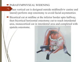 45
 PARASYMPHYSEAL WIDENING
 When vertical cut is designed outside midline(b/w canine and
lateral) perform step osteotomy to avoid facial asymmetries
 Bicortical cut at midline at the inferior border upto halfway,
then bicortical horizontal osteotomy cut to reach interdental
area, monocortical cut in interdental area and completed with
spatula osteotome.
 